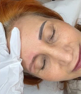 Sprâncene cu micropigmentare veche, dintr-o ședință de ștergere laser la Doina Beauty Center